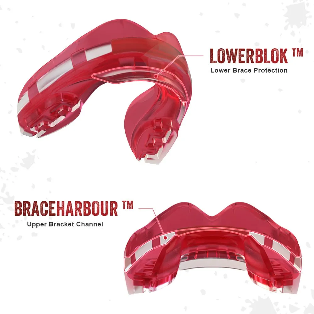 Protector Bucal Adulto Safejaws Ortho Series Rosado