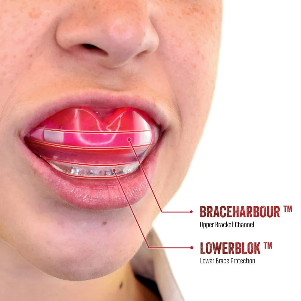 Protector Bucal Adulto Safejaws Ortho Series Rosado